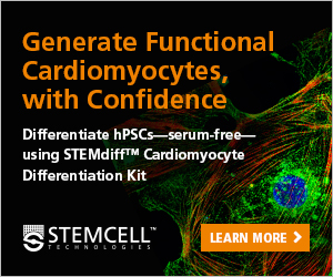 hPSC-derived cardiomycyte generated by STEMdiff™ Cardiomyocyte Differentiation Kit